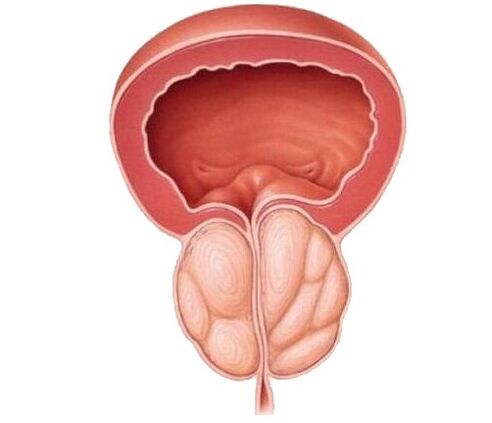Zvýšená prostata a léčba tobolky Urosaf