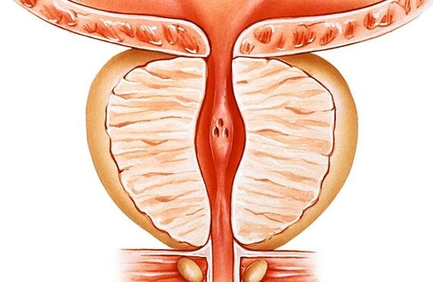 prostatitida